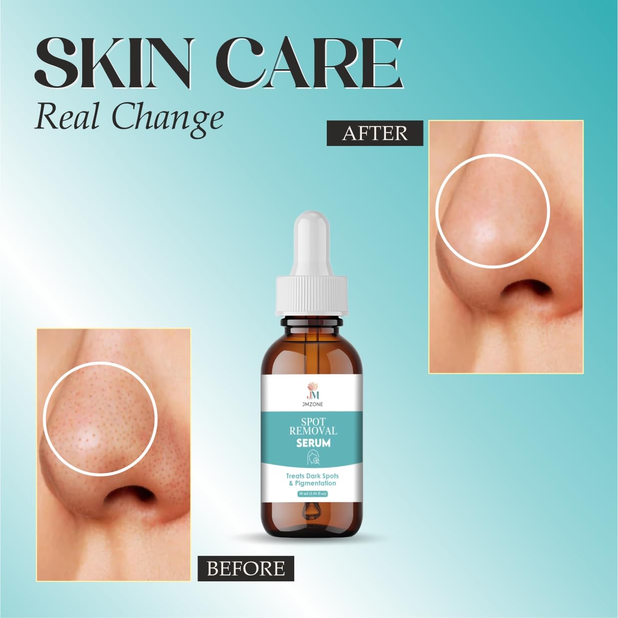 JMZONE Spot Removal Serum, Treats Dark Spots & Pigmentation, 30 ml