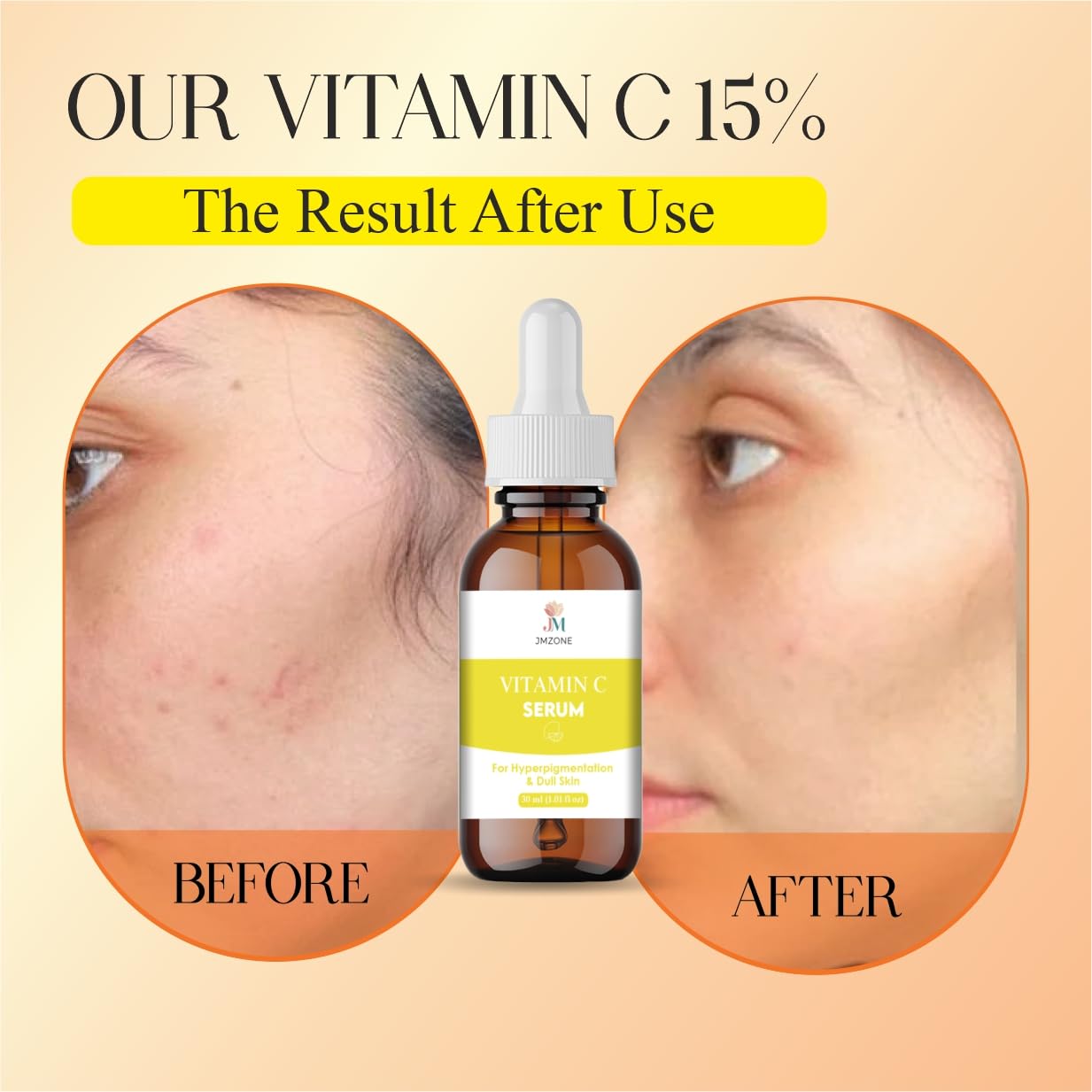 JMZONE Vitamin C Facial Serum with Brightening Care Formula for Uneven Looking Skin and Dryness, Non Sticky Daily Use Face Serum, 30 ml