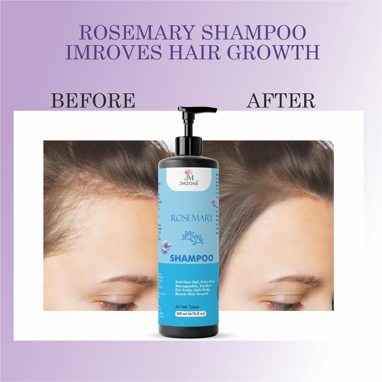 JMZONE Rosemary Hair Growth Shampoo, Anti Hair Fall, Frizz-Free, Soothes Dry Scalp, Boosts Hair Growth, All Hair Types, 200 ml