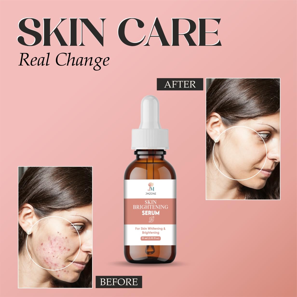 Jmzone Skin Brightening Serum, For Skin Whitening & Brightening, 30ml