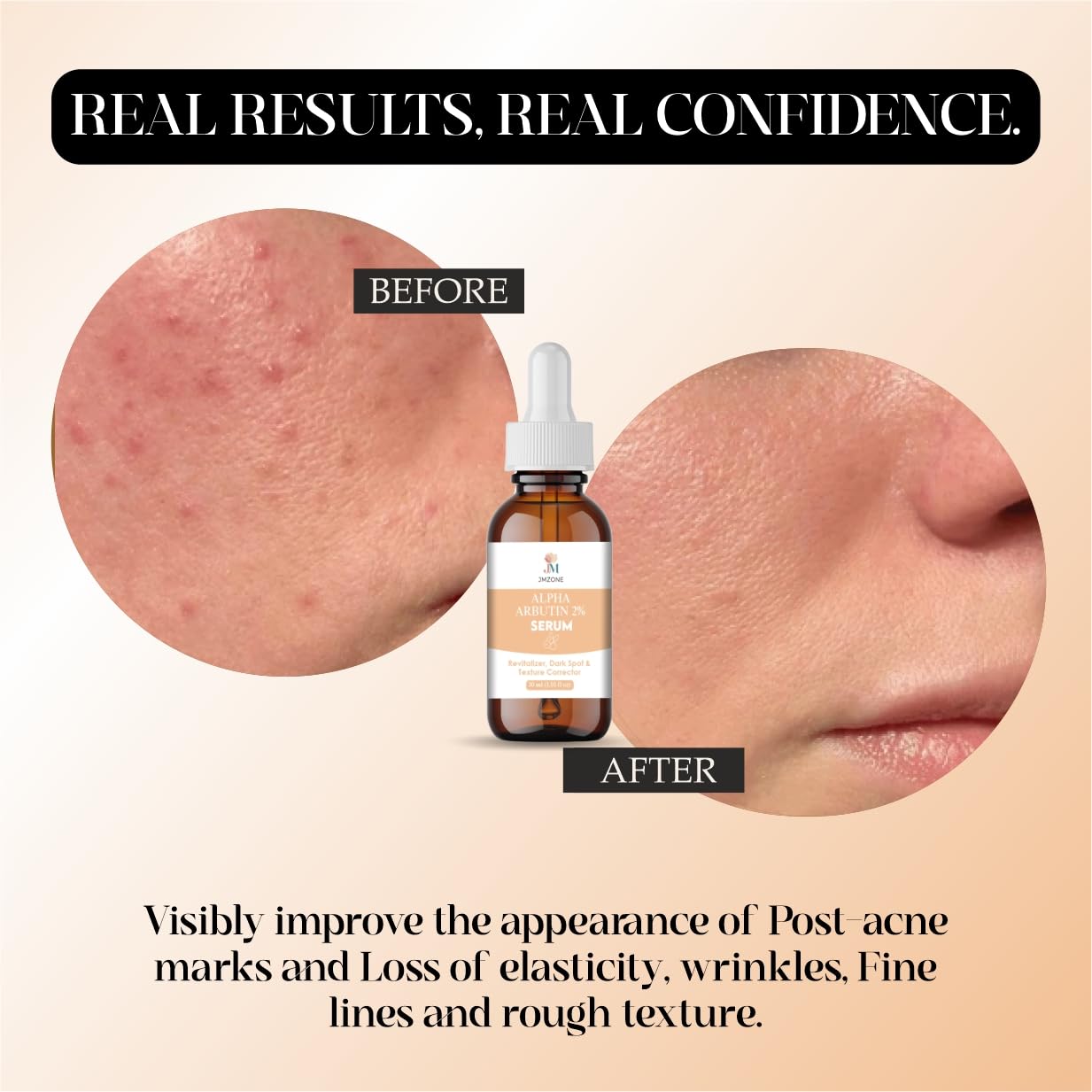 JMZONE Alpha Arbutin 2% Serum, Revitalizer, Dark Spot & Texture Corrector, 30 ml