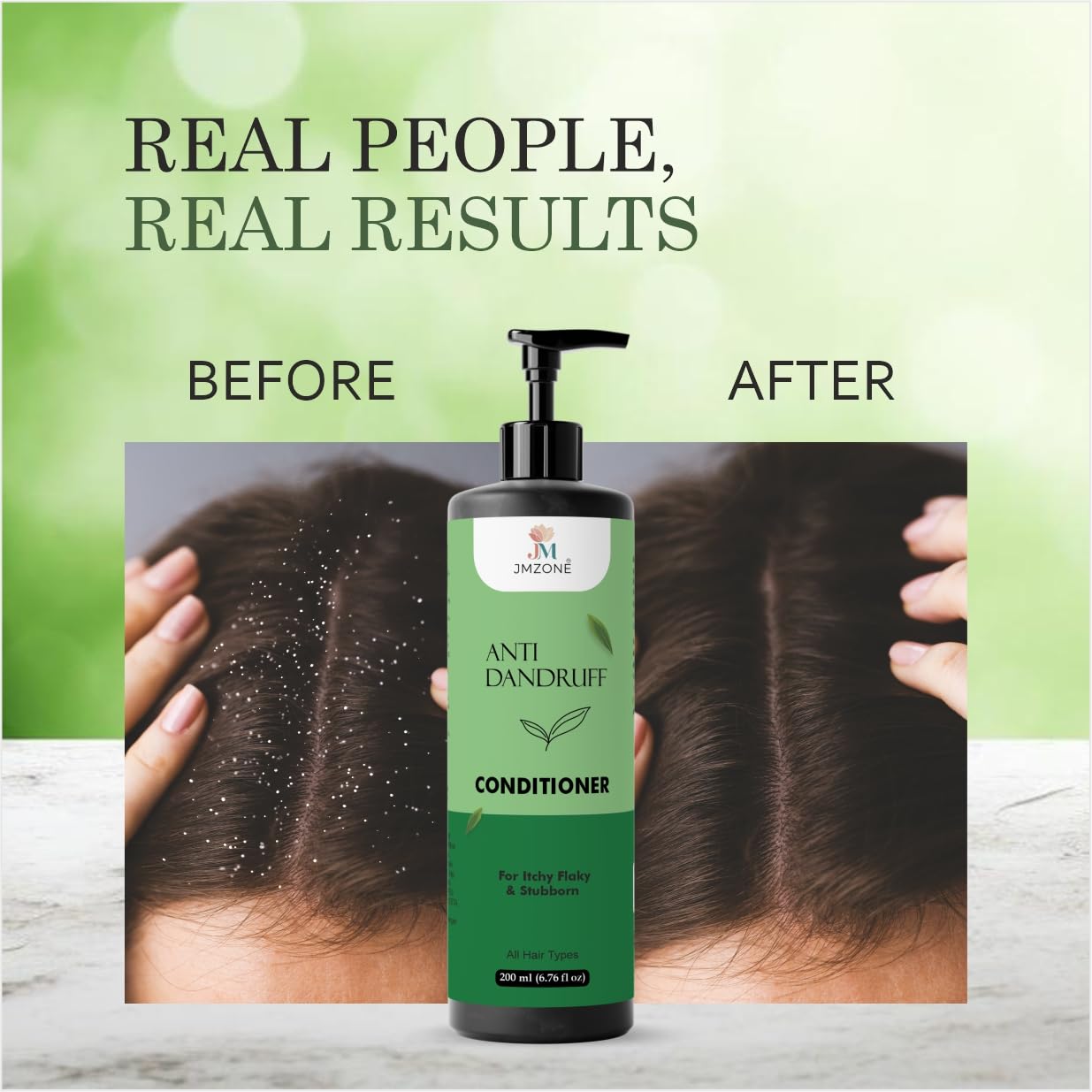 Jmzone Anti Dandruff Conditioner, for Itchy Flaky and Stubborn Dandruff, All Hair Types, Paraben Free, Sulphate Free, 200 ml