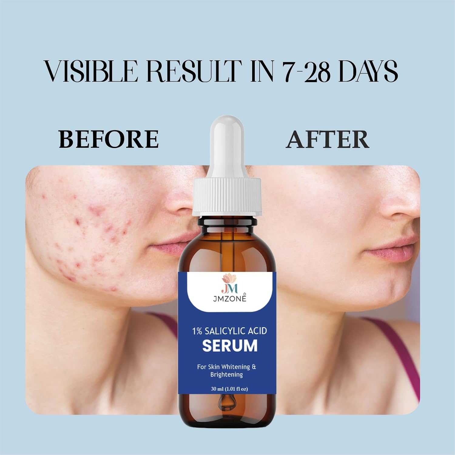 JMZONE 1% Salicylic Acid Serum for Acne, Blackheads & Oil Control – Exfoliating Face Serum for Clear, Smooth & Brighter Skin – Pore Minimizing & Skin Refining Formula – 30 ml