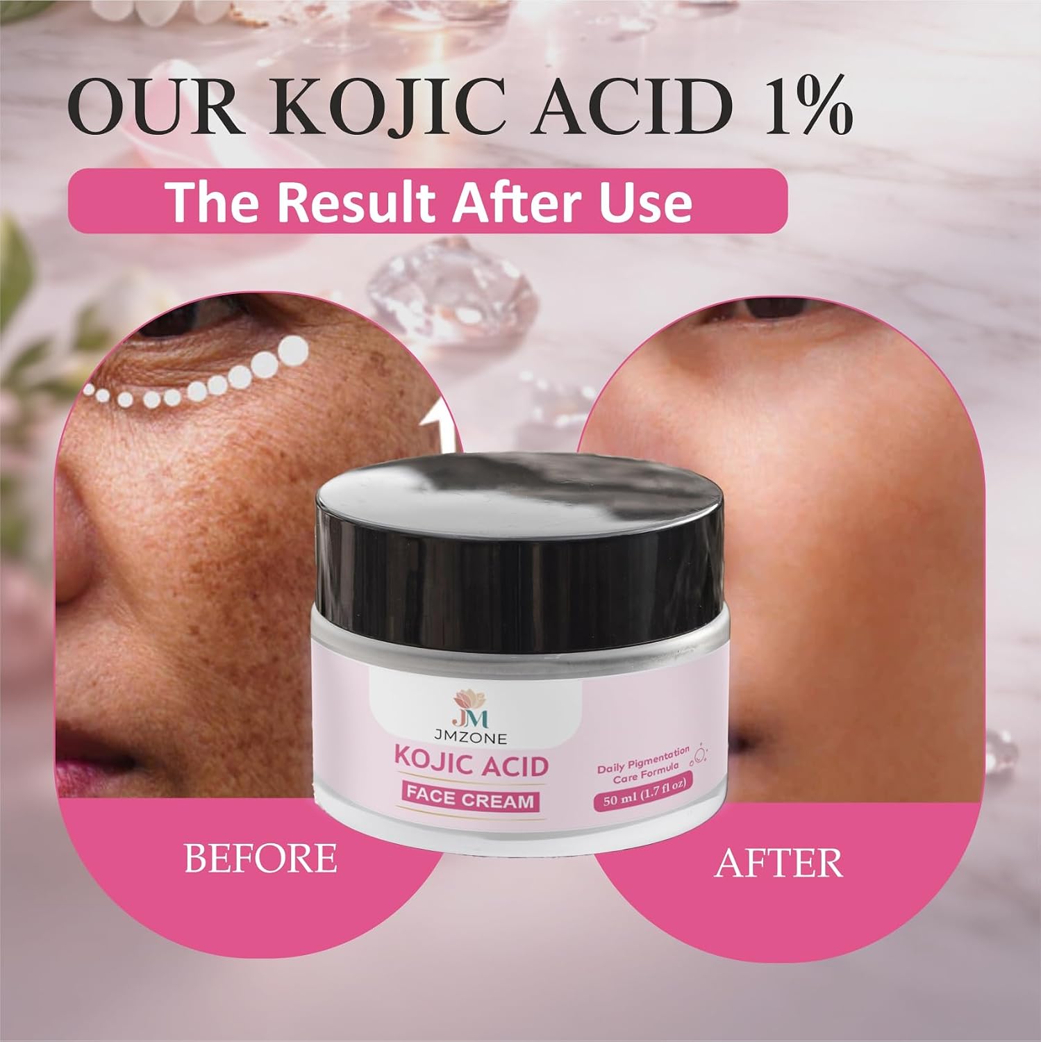 JMZONE Kojic Acid Face Cream, Daily Pigmentation Care Formula, with Niacinamide and Alpha Arbutin, 50ml